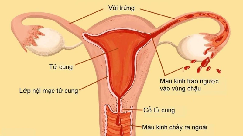 Dùng cốc nguyệt san làm sao đi vệ sinh 1