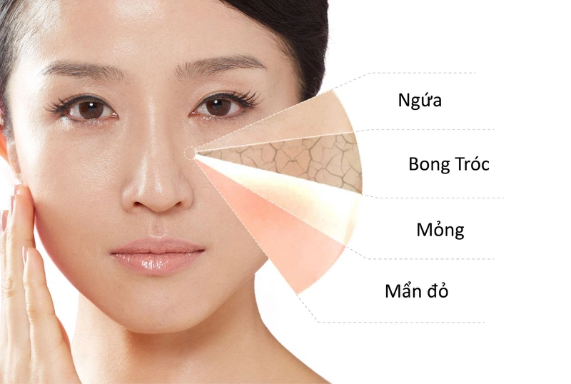 Dùng kem lột trắng da cấp tốc sẽ gặp phải những biến chứng gì? 2