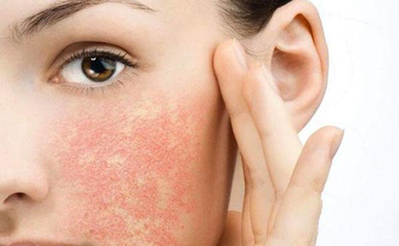 Tìm hiểu nguyên nhân dùng sữa rửa mặt bị nổi mụn 3
