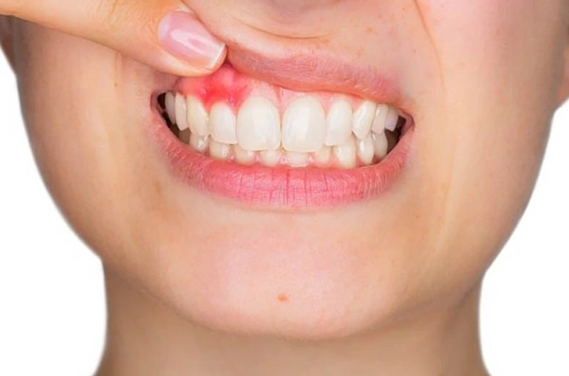 Đường phèn bao nhiêu calo và những món ăn giảm cân với đường phèn 3