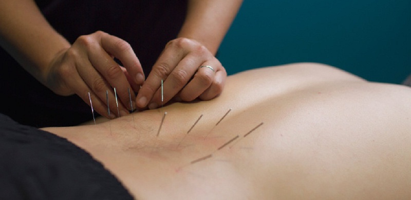 Gai cột sống tê tay cần phải được điều trị như thế nào để nhanh chóng khỏi bệnh3