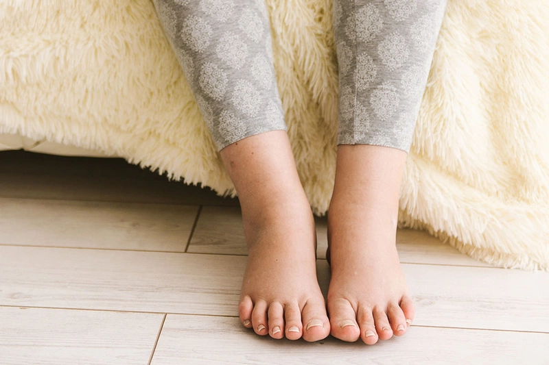 Gãy xương bàn chân Những điều bạn cần biết 3