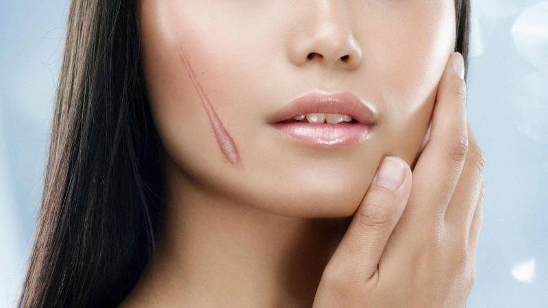 Gel ngừa sẹo Stratamed giá bao nhiêu, mua ở đâu 3