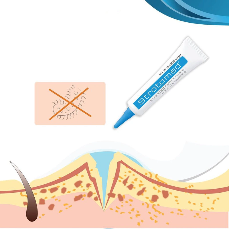 Gel ngừa sẹo Stratamed giá bao nhiêu, mua ở đâu 4