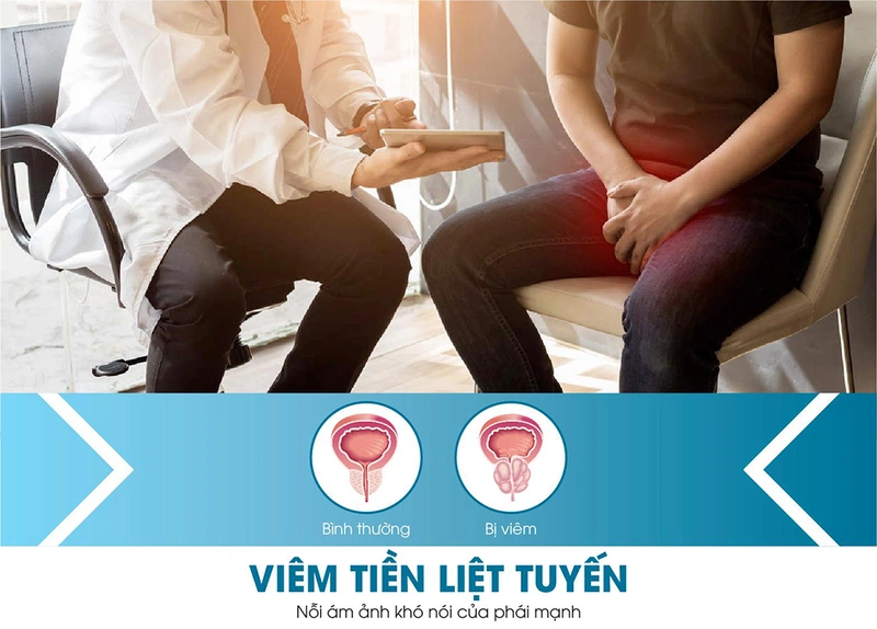 Giải đáp: Bệnh viêm tuyến tiền liệt có vô sinh không 1