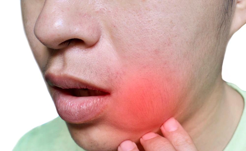 Giải đáp: Biến chứng quai bị ở nam giới có ảnh hưởng đến sức khỏe sinh sản không? 1