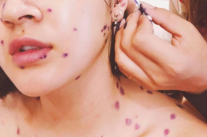 Giải đáp hiện tượng ngủ mở mắt có hại gì không? 2