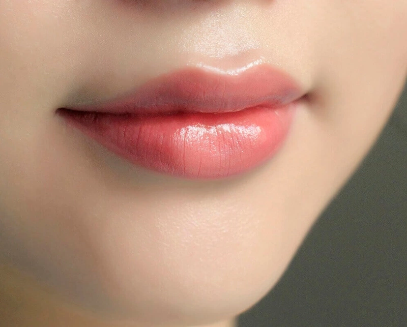 Giải đáp: Môi tiêm filler có phun được không?