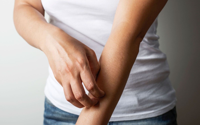 Giải đáp thắc mắc: Bệnh vảy nến á sừng có lây không?