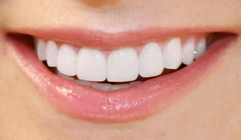 Bọc răng sứ: Giải pháp cải thiện tình trạng răng xấu nhanh chóng