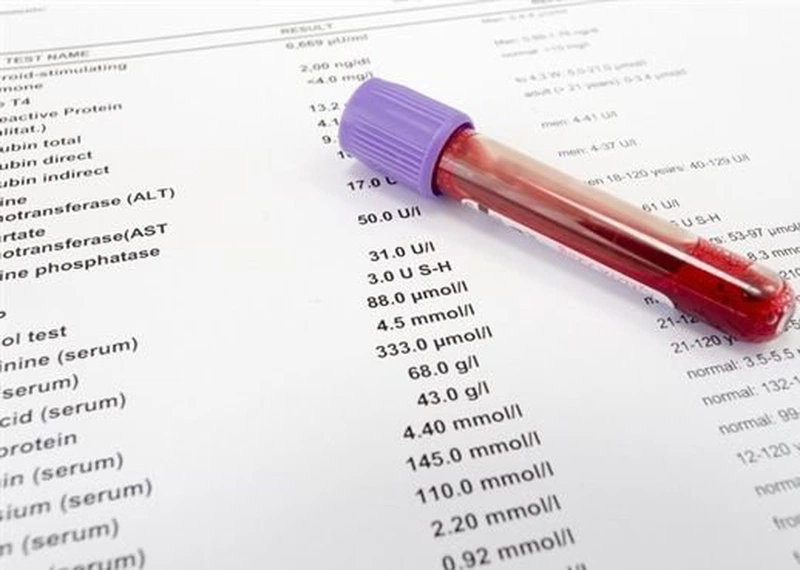 Chỉ số WBC trong xét nghiệm máu: Bí mật đằng sau sức khỏe hệ miễn dịch