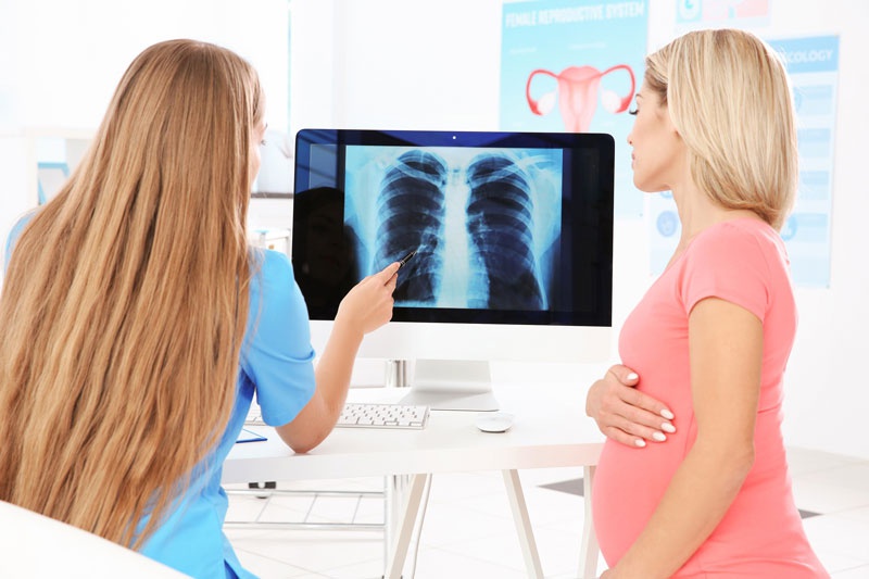 Giải đáp thắc mắc “Chụp X-quang có phát hiện ung thư phổi không?”