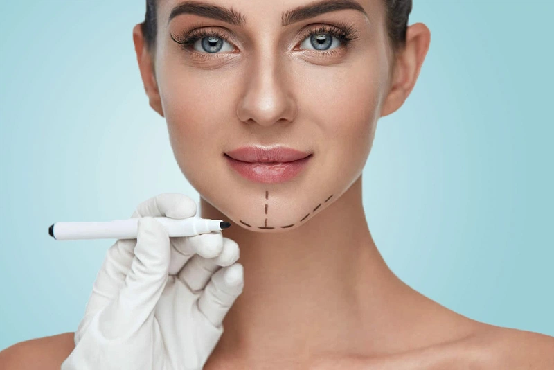 Giải đáp thắc mắc Độn cằm có được vĩnh viễn không 1