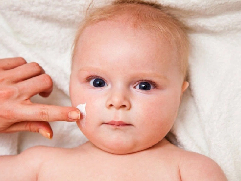 Kem Sudocrem có bôi mặt được không là câu hỏi của rất nhiều người