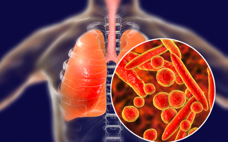 Giải đáp thắc mắc: Mẹ bị lao phổi có cho con bú được không?1