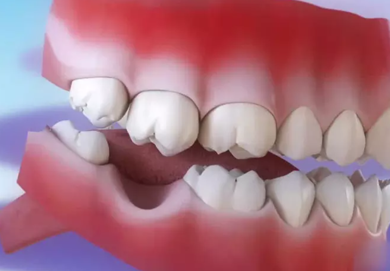 Răng vĩnh viễn có mọc lại không là thắc mắc của nhiều người