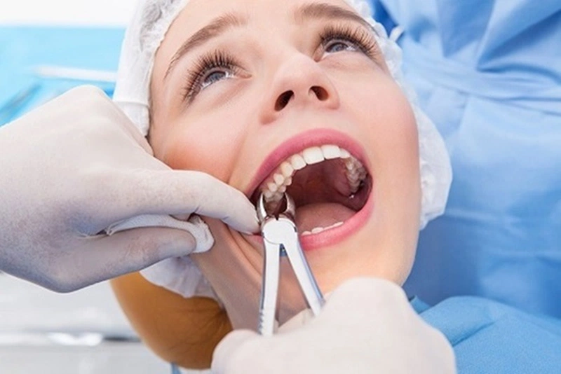 ​​​​​​​  Những cách khắc phục khoảng trống răng bị nhổ vĩnh viễn hiện nay