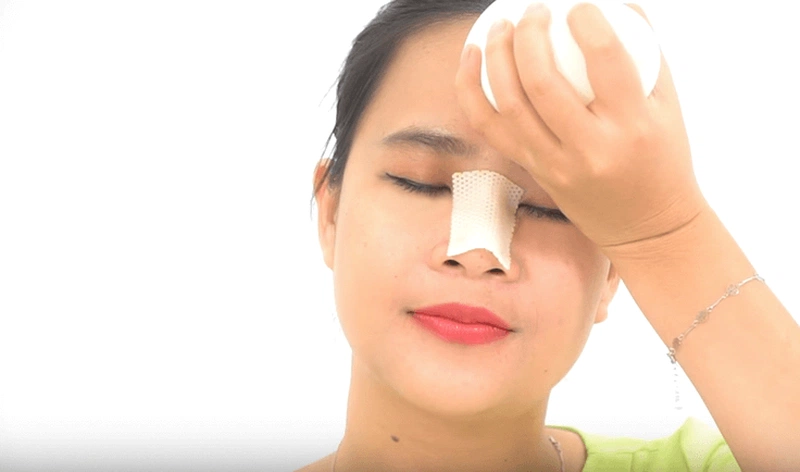 Hạn chế thịt ếch để tránh những biến chứng sau nâng mũi