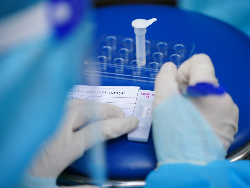 Test covid PCR bao lâu có kết quả và có chính xác hay không là vấn đề được nhiều người quna tâm