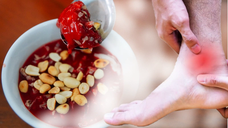 Bệnh gút có ăn được tiết canh không? - Không nên ăn tiết canh khi đang điều trị bệnh gút