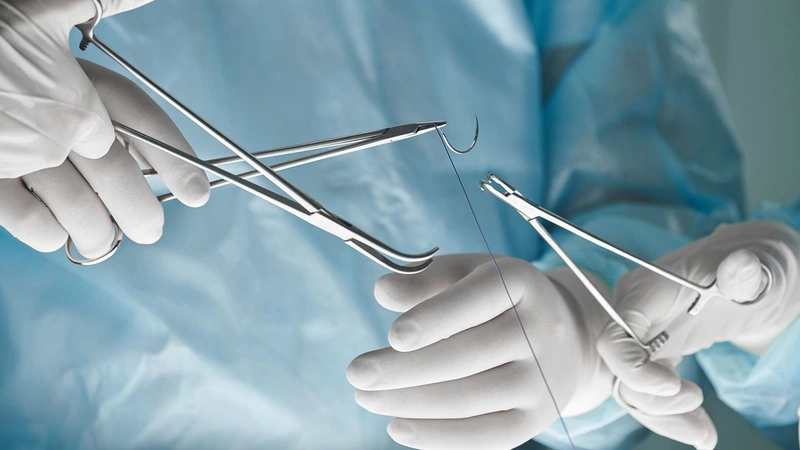 Giải đáp thắc mắc: Vết khâu tầng sinh môn bị nổi cục là do đâu?2