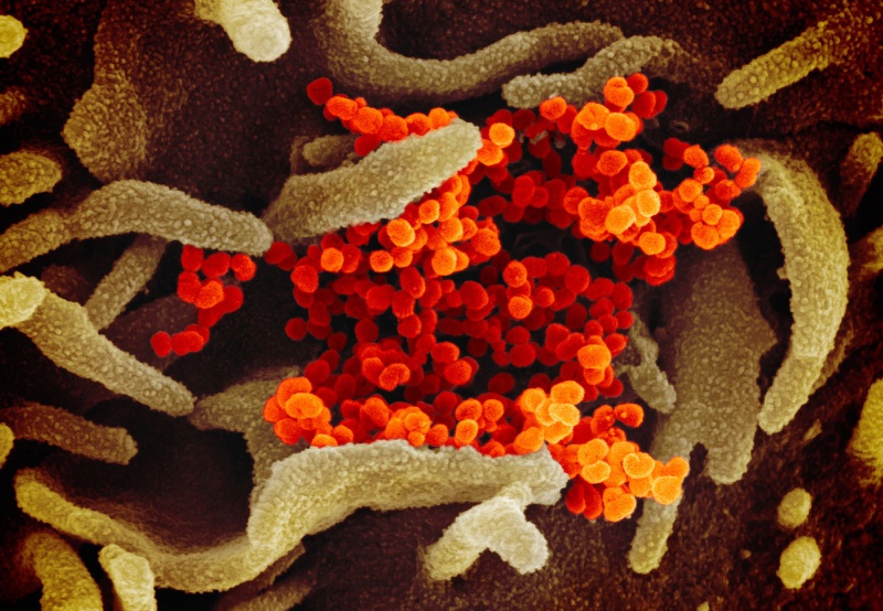 Giải mã nguy cơ virus corona tàn phá trong cơ thể 1