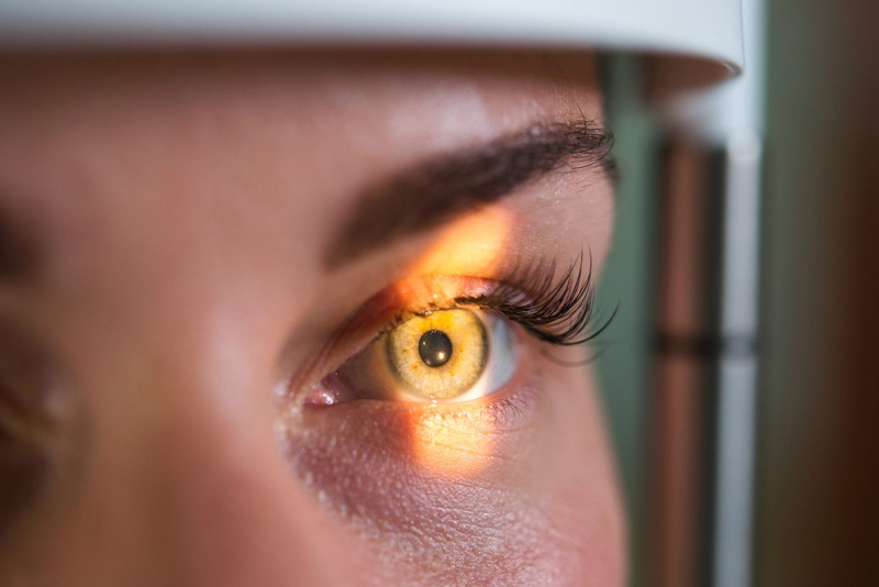Glaucoma là bệnh gì? Có thể chữa trị không? Cách điều trị như thế nào? 2