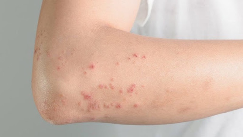 Góc giải đáp: hoạt huyết dưỡng não có tác dụng gì? 3