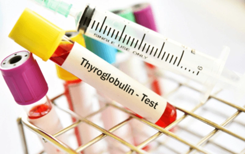 Góc giải đáp thắc mắc: Bướu cổ cần xét nghiệm gì? 2