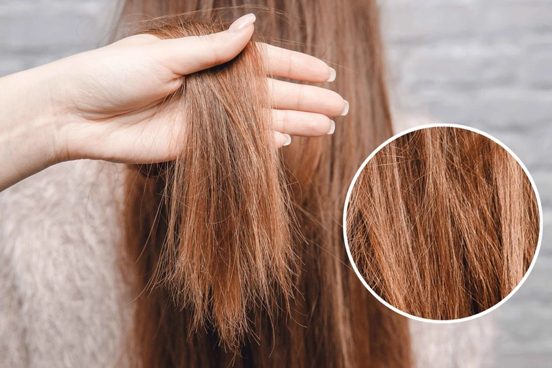 Tác dụng của việc gội đầu bằng nước muối và các lưu ý cần ghi nhớ 3