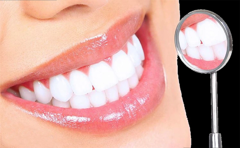 Làm trắng răng bằng cau tươi cần kiên trì thực hiện