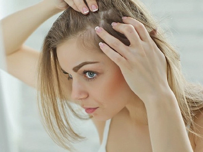 Gợi ý những cách trị chấy hiệu quả ngay tại nhà 2