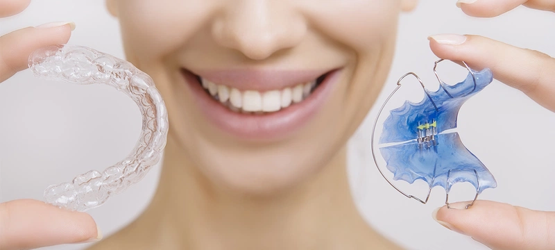Hàm duy trì là gì và cần đeo bao lâu sau khi tháo niềng 3