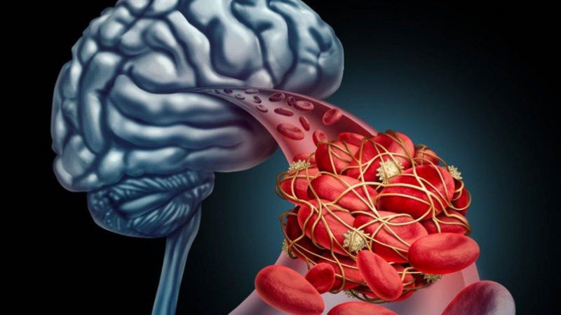 Hậu Covid giảm trí nhớ nguyên nhân và cách khắc phục 1