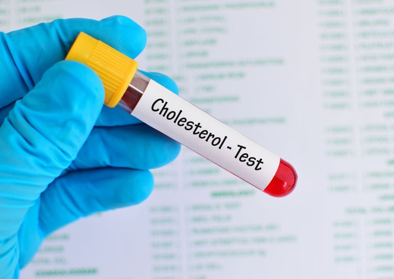 HDL cholesterol là gì và những cảnh báo sức khỏe khi chỉ số HDL cholesterol giảm 1