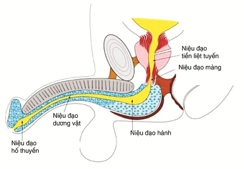 Hẹp niệu đạo thường xảy ra ở nam giới