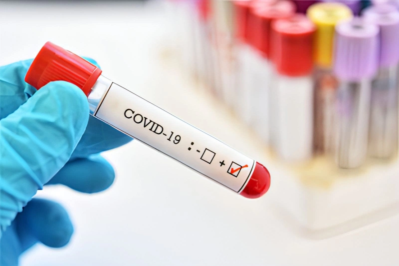 Hiểu đúng về thông tin chỉ số CT là gì?