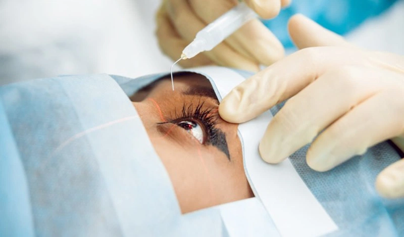 Hiểu đúng về thuốc nhỏ mắt trị thoái hóa điểm vàng