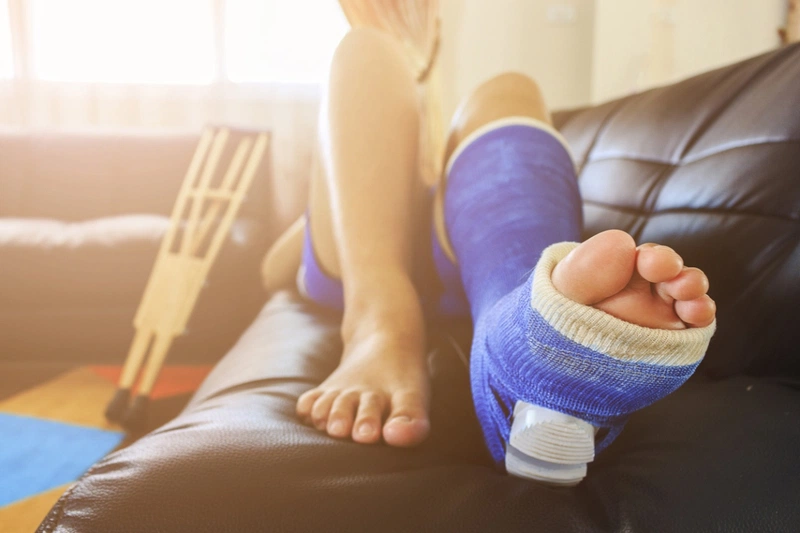 Hình ảnh bong gân bàn chân chi tiết nhất và cách điều trị 3