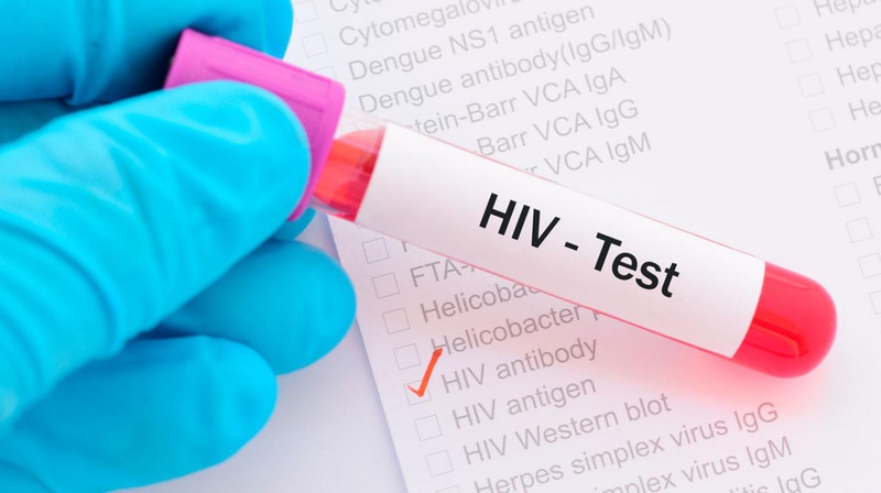HIV có những giai đoạn bệnh nào? Các dấu hiệu nhiễm HIV sau 3 tháng bạn cần chú ý 3