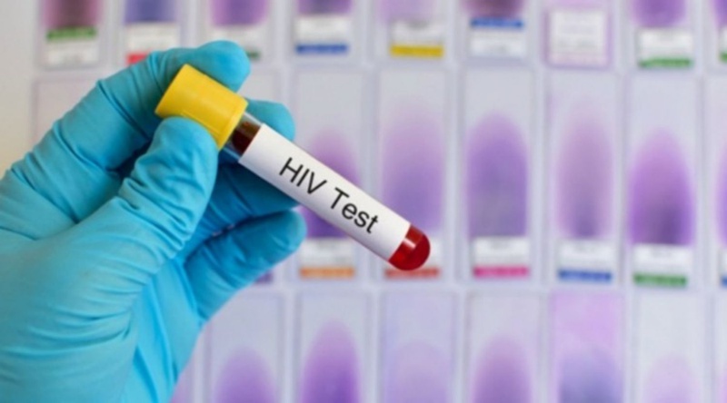 HIV là gì? HIV xâm nhập vào cơ thể tồn tại bao lâu? 5