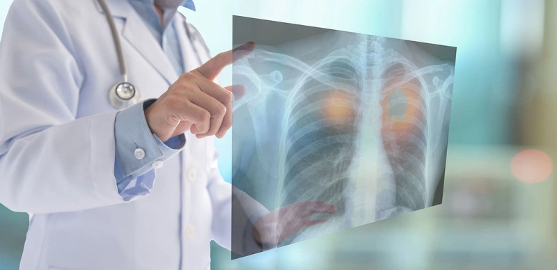 Ho có đờm xanh là dấu hiệu của bệnh hô hấp nguy hiểm?2