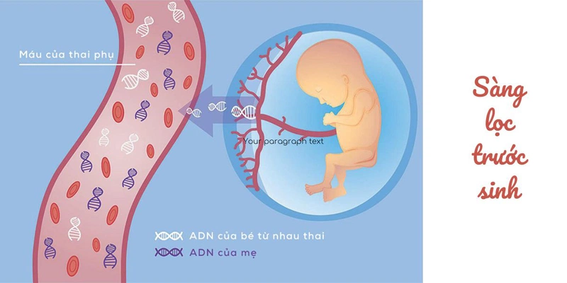Hội chứng DiGeorge và những điều liên quan có thể bạn chưa biết 3