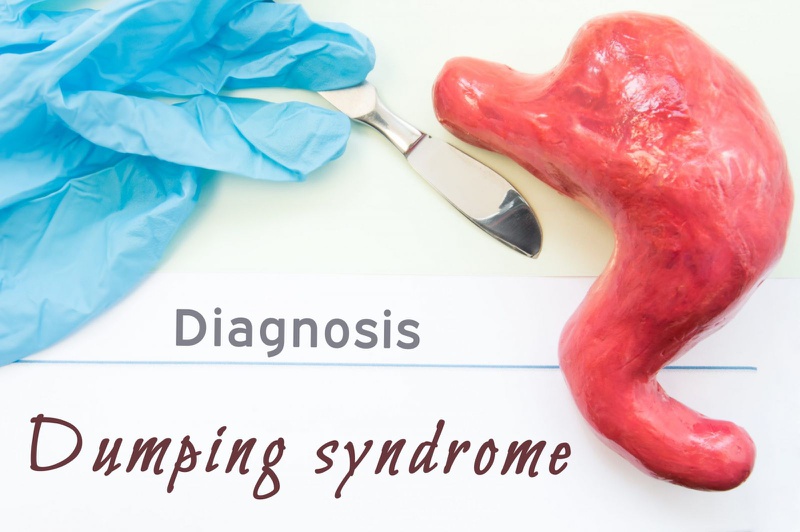 Hội chứng Dumping: Nguyên nhân, triệu chứng và cách phòng ngừa.