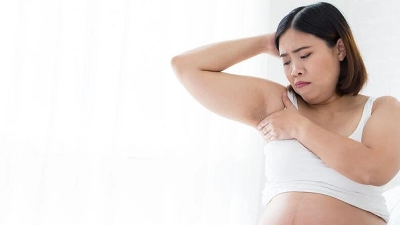 Hôi nách khi mang thai và cách điều trị tốt cho sức khỏe mẹ bầu 1