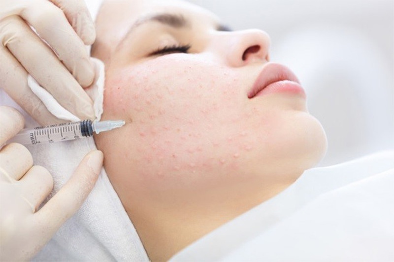 Hướng cách cách chăm sóc da sau tiêm meso 2
