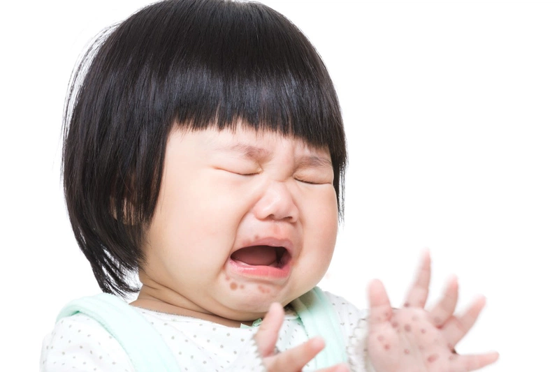Hướng dẫn cách chăm sóc bé bị tay chân miệng không chịu ăn 2