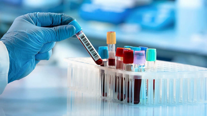 Hướng dẫn cách phòng chống virus Zika an toàn và hiệu quả 3