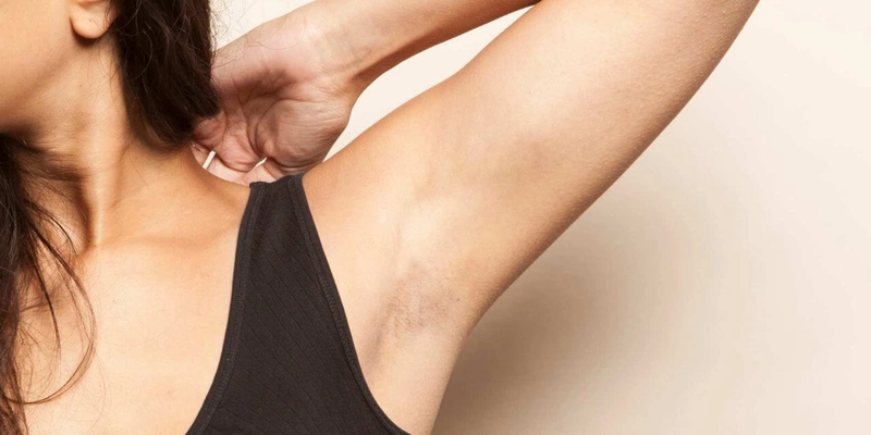 Veet là loại kem tẩy lông được nhiều chị em lựa chọn để giúp đem lại làn da dưới cánh tay mịn màng