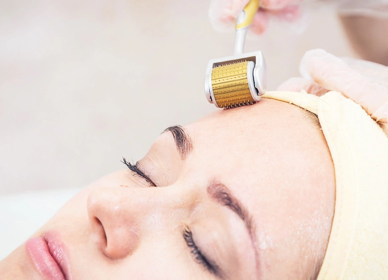 Công nghệ PRP trẻ hóa da